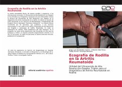 Ecografía de Rodilla en la Artritis Reumatoide