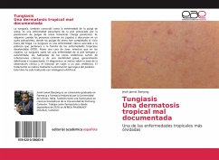 TungiasisUna dermatosis tropical mal documentada - Jamet Banjong, Jinoh