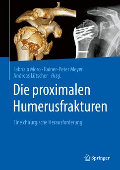 Die proximalen Humerusfrakturen (eBook, PDF)