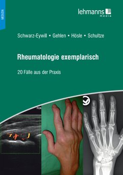 Rheumatologie exemplarisch (eBook, PDF) - Schwarz-Eywill, Michael; Gehlen, Martin; Hösle, Rosmarie; Schultze, Mareen