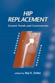 Hip Replacement (eBook, ePUB)
