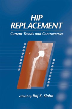 Cover Hip Replacement (eBook, ePUB)