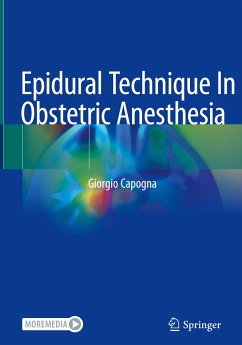 Epidural Technique In Obstetric Anesthesia - Capogna, Giorgio