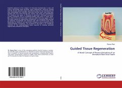 Guided Tissue Regeneration - Rani, Reena