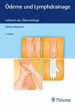 Ödeme und Lymphdrainage - Herpertz, Ulrich