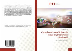 Cytoplasmic-ANCA dans le lupus érythémateux disséminé - El Youbi, Randa