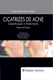 Cicatrizes de Acne (eBook, ePUB)
