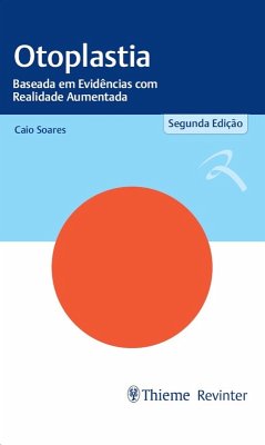 Cover Otoplastia (eBook, ePUB)