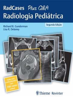 Cover RedCases Plus Q&A Radiologia Pediátrica (eBook, ePUB)