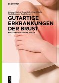 Gutartige Erkrankungen der Brust (eBook, ePUB)