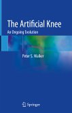 The Artificial Knee (eBook, PDF)