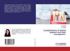 Complications of dental implant and their managment