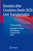Donation after Circulatory Death (DCD) Liver Transplantation
