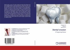 Dental erosion - R, Ranjitha G.;R, Vikram;S, Adarsha M.