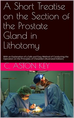 Cover A Short Treatise on the Section of the Prostate Gland in Lithotomy (eBook, PDF)