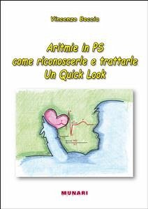 Aritmie in PS come riconoscerle e trattarle. Un Quick Look (eBook, PDF) - Vincenzo, Boccia