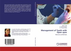 Management of Tooth with Open apex - Patil, Sayli P.;Chaudhari, Salil;Sarda, Poonam