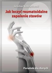Jak leczyć reumatoidalne zapalenie stawów (eBook, ePUB) - Niebrzydowski, Jarosław