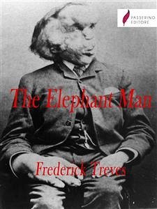 The Elephant Man (eBook, ePUB) - Treves, Frederick