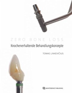 Zero Bone Loss: Knochenerhaltende Behandlungskonzepte - Linkevicius, Tomas