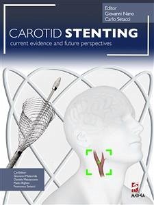Carotid Stenting (eBook, PDF) - Nano, Giovanni; Setacci, Carlo