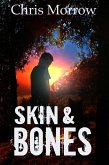 Skin & Bones (eBook, ePUB) Skin & Bones (eBook, ePUB)