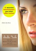 Akne-Behandlung (eBook, ePUB)