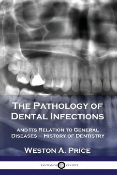 The Pathology of Dental Infections - Price, Weston A.