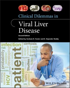 Clinical Dilemmas in Viral Liver Disease (eBook, ePUB)