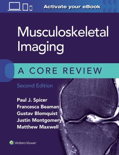 Musculoskeletal Imaging: A Core Review - Spicer, Paul; Beaman, Francesca; Blomquist, Gustav