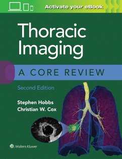 Thoracic Imaging: A Core Review - Hobbs, Stephen; Cox, Christian