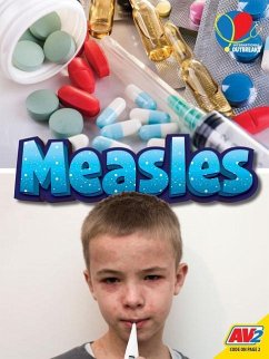 Measles - Hudak, Heather C