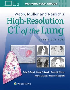 Webb, Muller and Naidich's High Resolution of Lung CT - Desai, Sujal; Lynch, David; Elicker, Brett M, MD