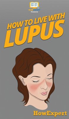 How To Live With Lupus - Howexpert