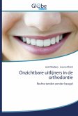 Onzichtbare uitlijners in de orthodontie