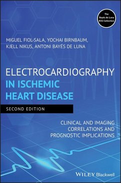 Cover Electrocardiography in Ischemic Heart Disease (eBook, ePUB)