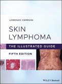 Skin Lymphoma