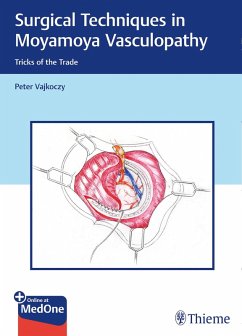 Cover Surgical Techniques in Moyamoya Vasculopathy (eBook, PDF)