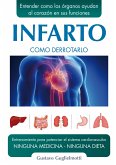 Infarto (eBook, ePUB)