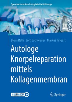 Autologe Knorpelreparation mittels Kollagenmembran (eBook, PDF) - Rath, Björn; Eschweiler, Jörg; Tingart, Markus