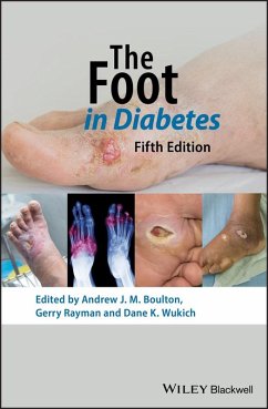 Cover The Foot in Diabetes (eBook, PDF)