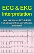 ECG & EKG Interpretation (eBook, ePUB) - Bild 1