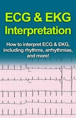 ECG & EKG Interpretation (eBook, ePUB) - Pine, Jeremy