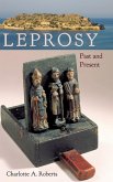 Leprosy Leprosy