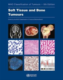 Soft Tissue and Bone Tumours - Who Classification of Tumours Editorial Board