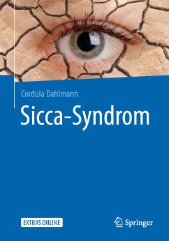 Sicca-Syndrom (eBook, PDF) - Dahlmann, Cordula