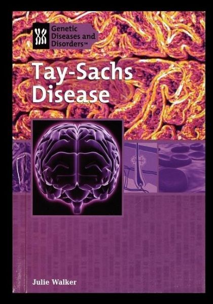 Tay-Sachs Disease Tay-Sachs Disease