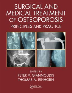 Cover Surgical and Medical Treatment of Osteoporosis (eBook, PDF)