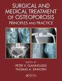 Surgical and Medical Treatment of Osteoporosis (eBook, ePUB)