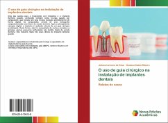 O uso de guia cirúrgico na instalação de implantes dentais - Larocca de Geus, Juliana;Salem Ribeiro, Gustavo